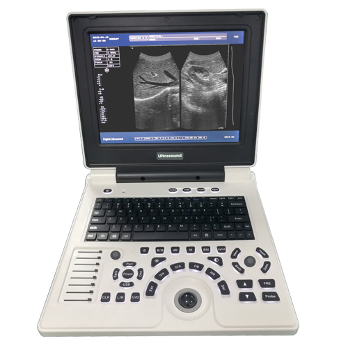 ISO13485 Xf30b Cheap Price Hottest Portable B/W Medical Ultrasound Machine Scanner