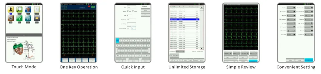 Digital 12 Lead ECG Features