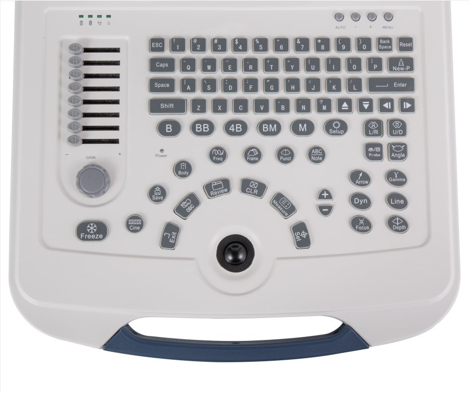 Dawei Laptop Medical Equipment Dw-580 Black and White Ultrasound Scanner for Abdomen