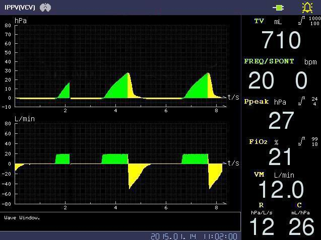 Manufacturer Wholesale Top Grade Hospital ICU Clinic Surgical Operation Room Anesthesia Machine