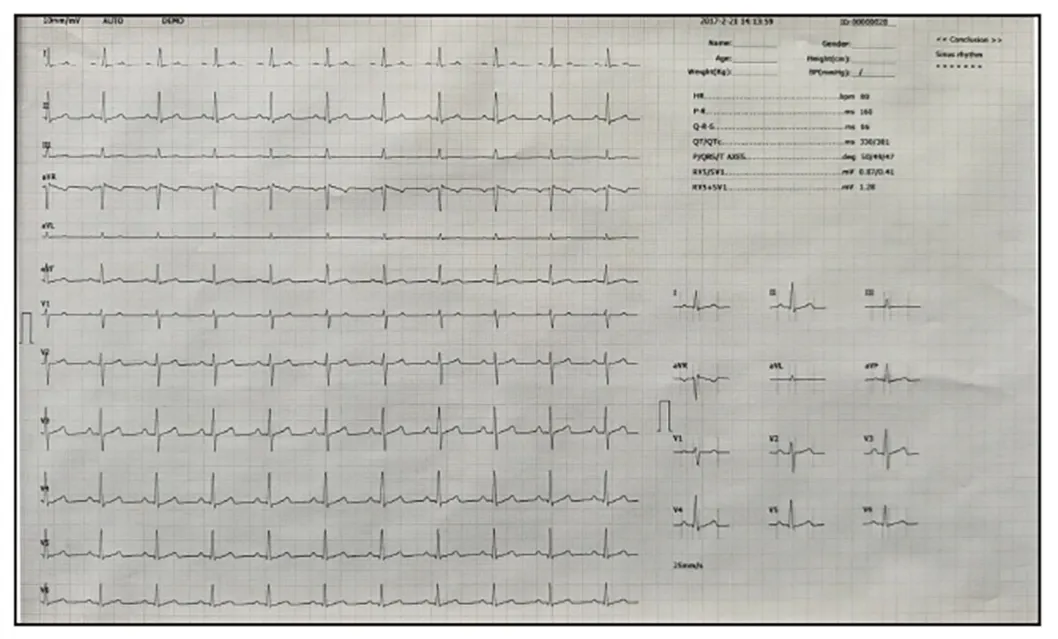 ECG 1