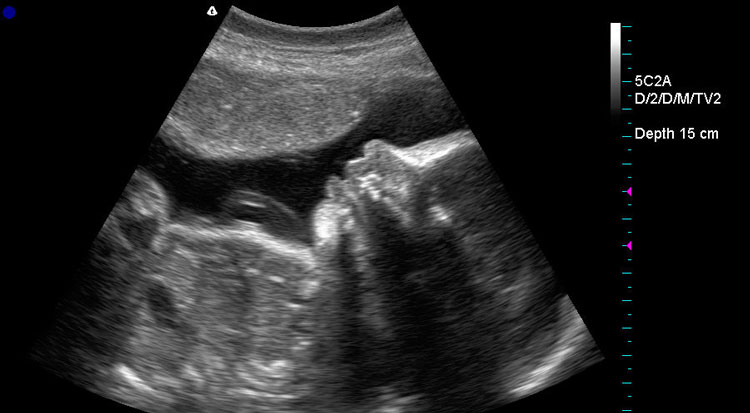 My-A024A 3D Color Doppler Ultrasound Scanner