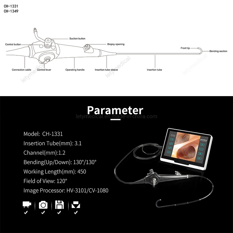 HD Flexible Video Choledochoscope Gallbladder Endoscope Electronic Endoscope