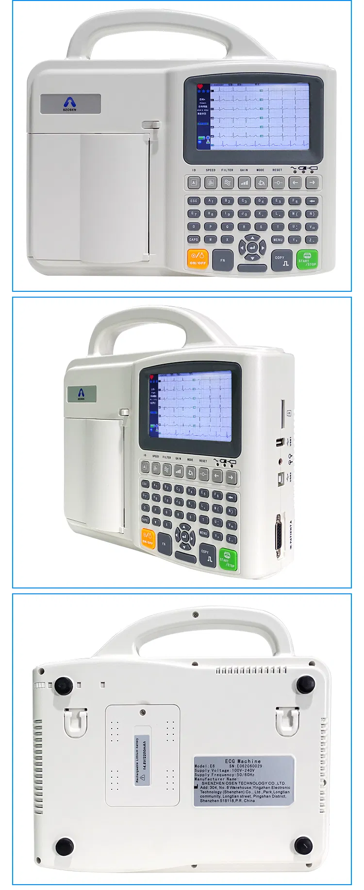 ECG Measurement Chart