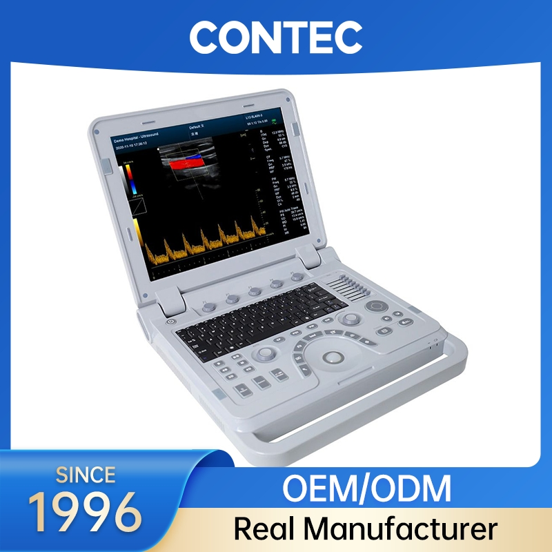 Contec Cms1700b Portable Laptop Color Doppler 4D Ultrasound Machine