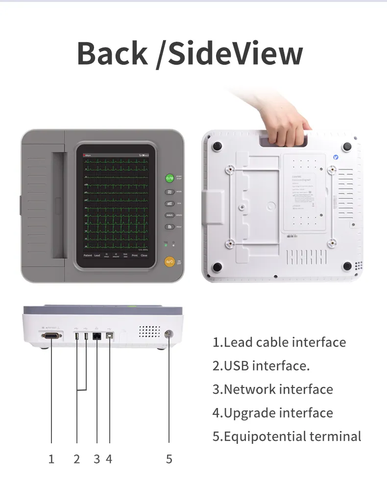 ECG Device View 3
