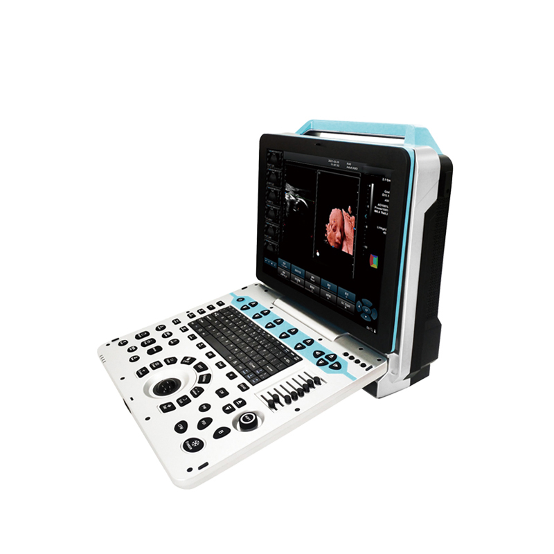 Portable Full Digital Laptop Ultrasonic Diagnostic System Ultrasound Scanner Machine with Probes for Clinic Hospital