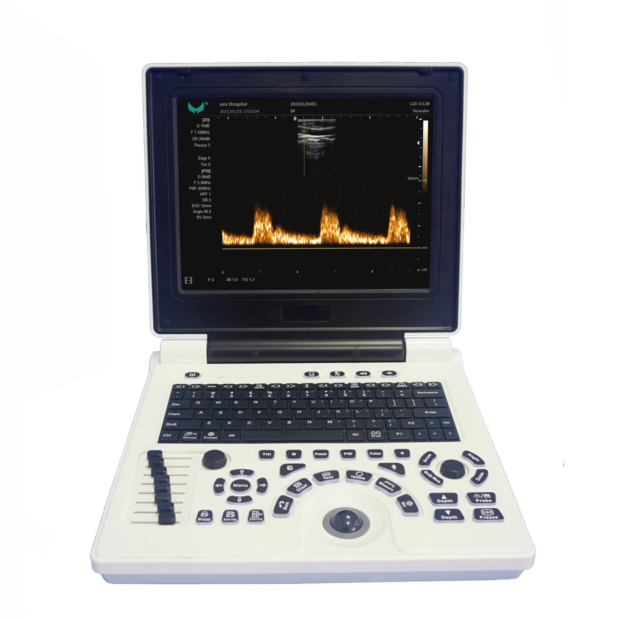 U10b Ultrasound Equipment Black and White Cheap Price Laptop Ultrasound Scanner