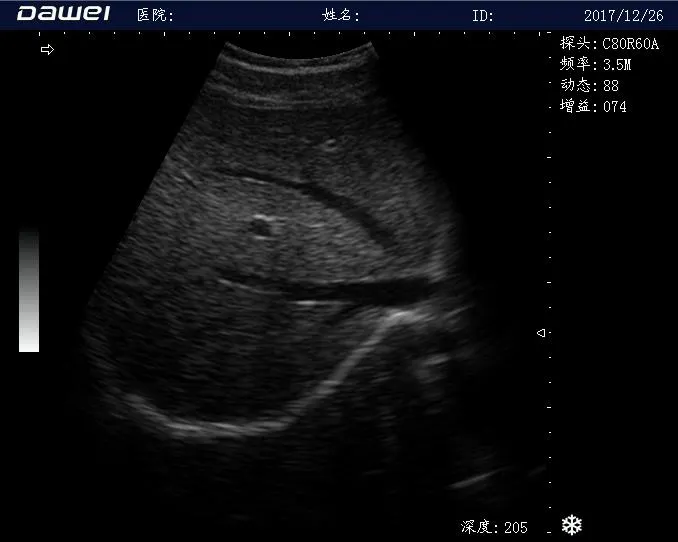Ultrasound Image 2