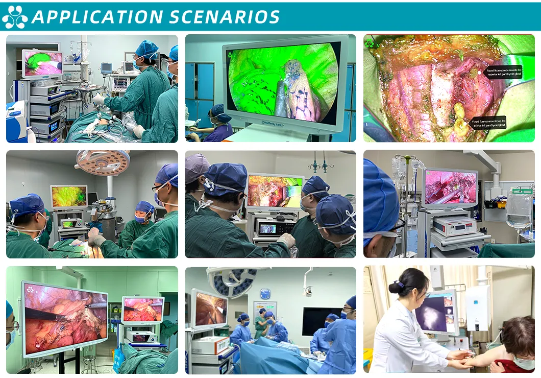 Application of Rigid Optical Endoscope