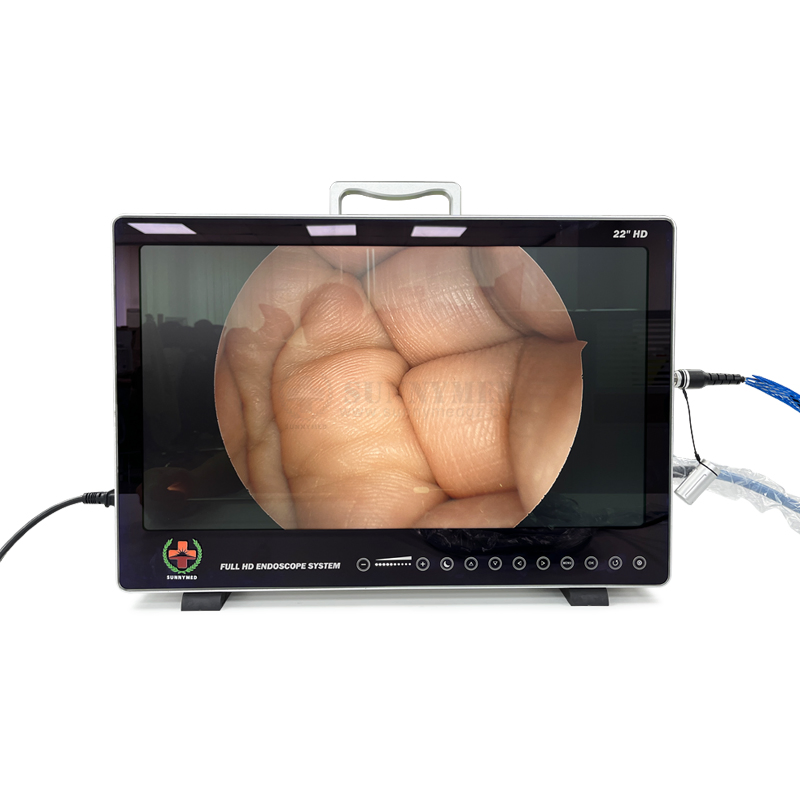 Sy-PS050 Medical Equipment Full HD Camera Endoscope for Ent Urology Laparoscopy Endoscopy