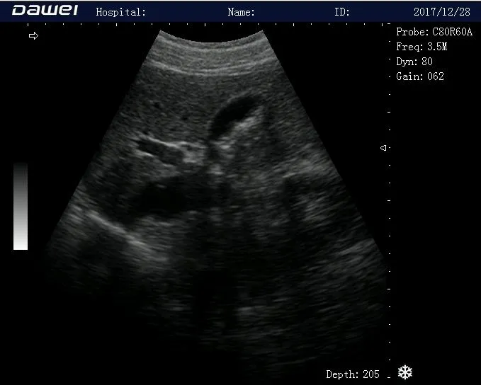 Ultrasound Image 3