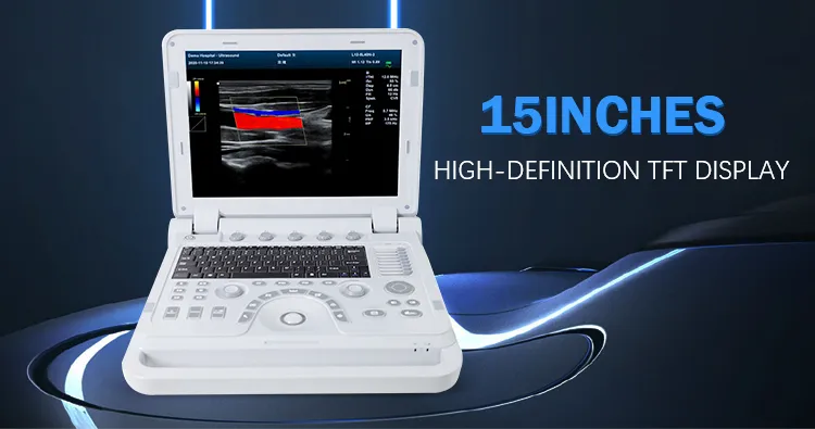 Ultrasound Device View 4