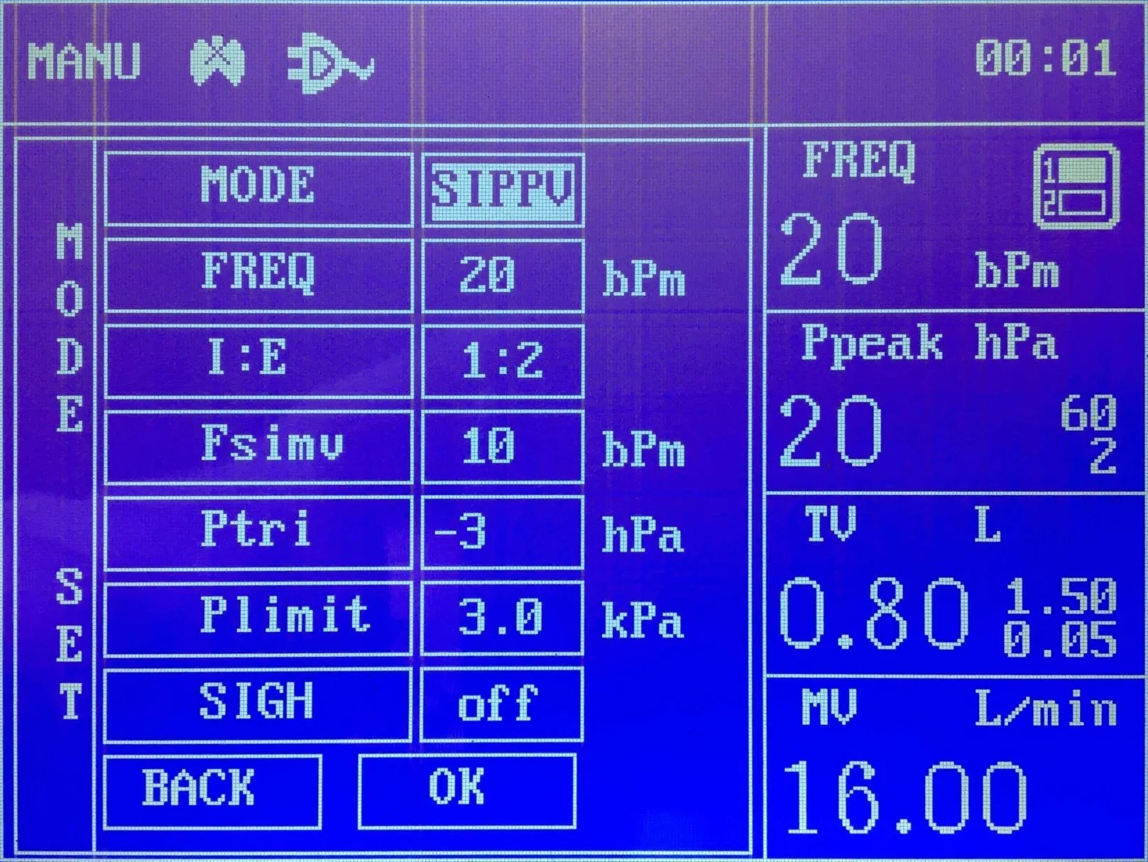 Surgical Practical Medical Equipment ISO Approved Jinling 01b Anesthesia Machine