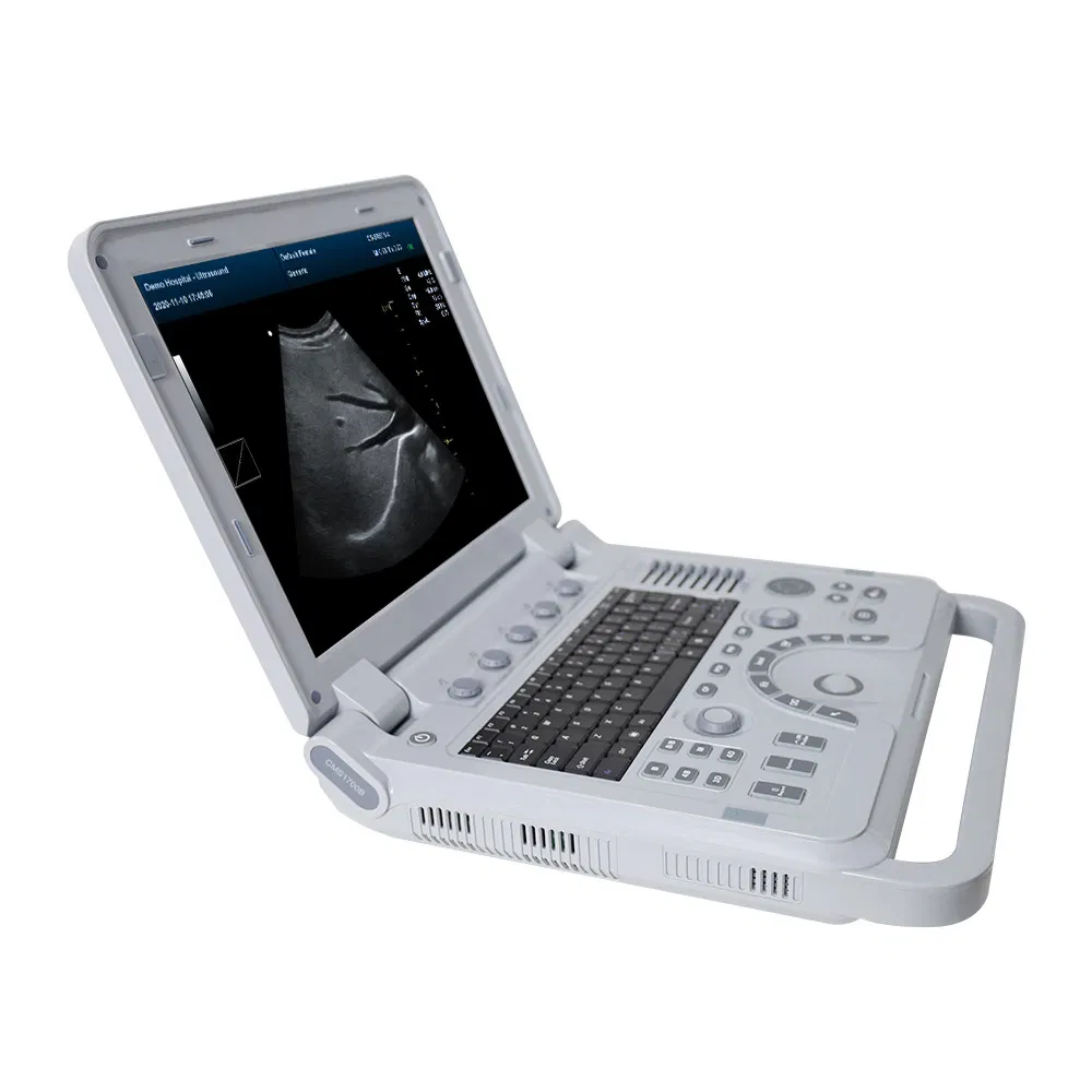 Contec Cms1700b Portable Laptop Color Doppler 4D Ultrasound Machine