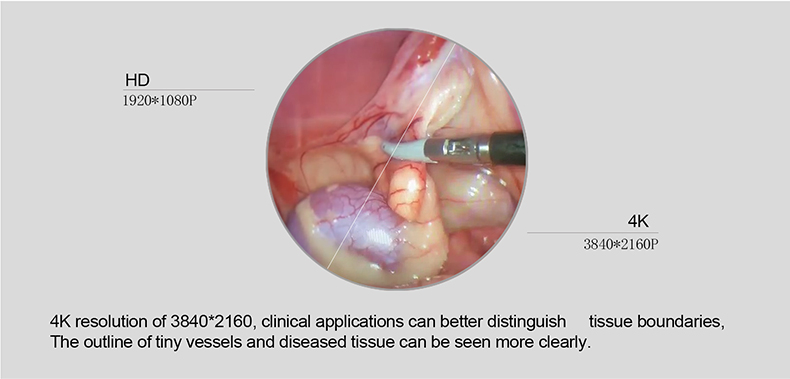 Medical 4K UHD Laparoscopic Tower Complete Endoscope Camera System Set