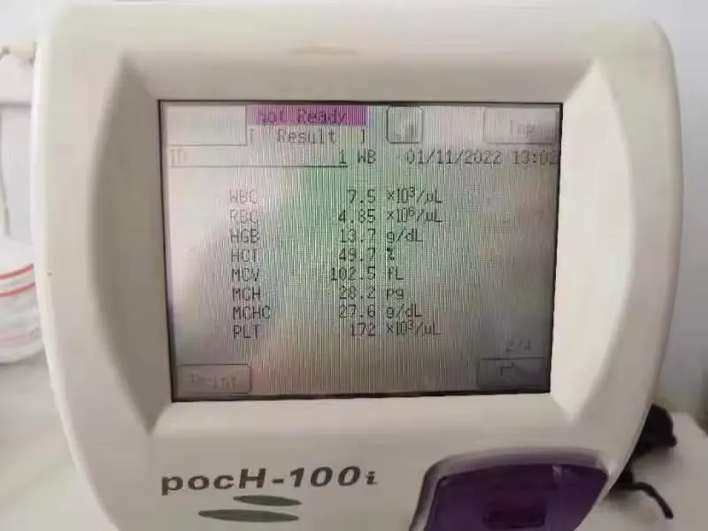 Hematology Analyzer View 2