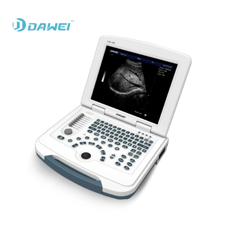 Dawei Laptop Medical Equipment Dw-580 Black and White Ultrasound Scanner for Abdomen