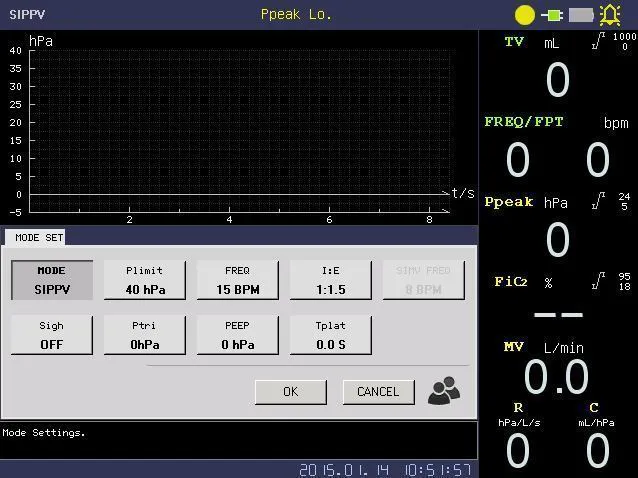 ICU Ventilator View 3