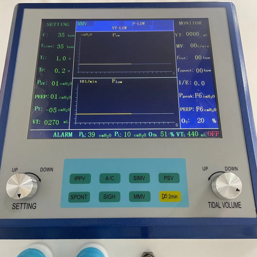 ICU Ventilator Component 2