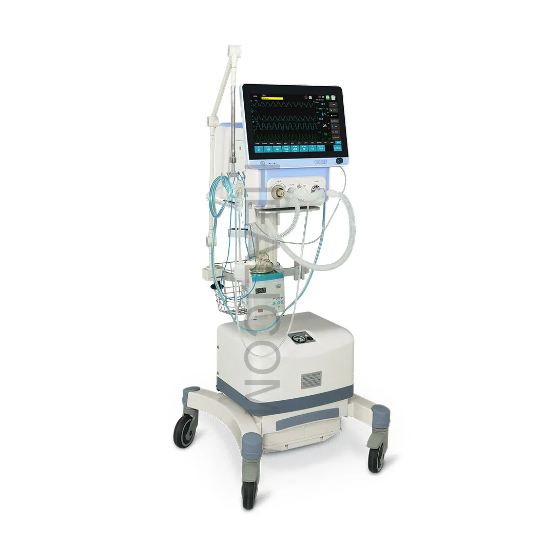 Ventilator Features