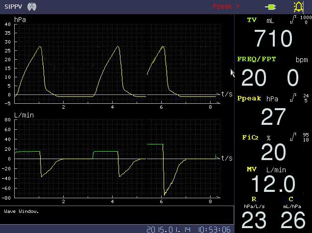 Adult and Infant ICU Turbine Ventilator Puao Med (PA-700B) with High Flow Therapy