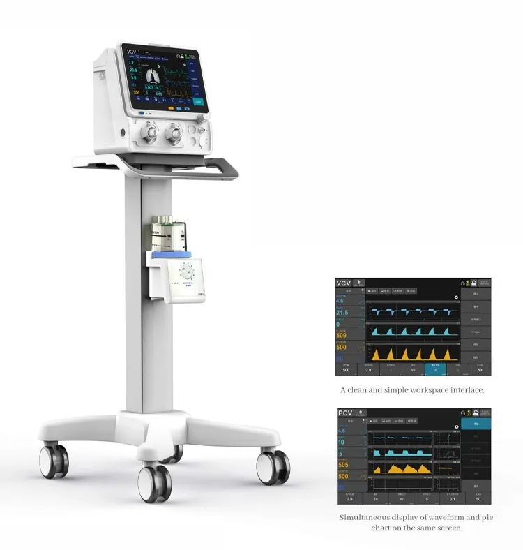ICU Ventilator Interface