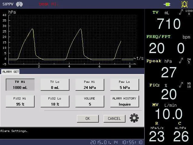 ICU Ventilator View 6