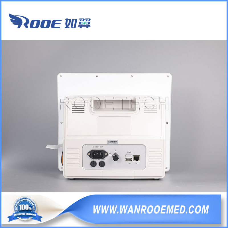 Customized Medical Multimodal Portable Multi-Language Bedside Patient Monitor System