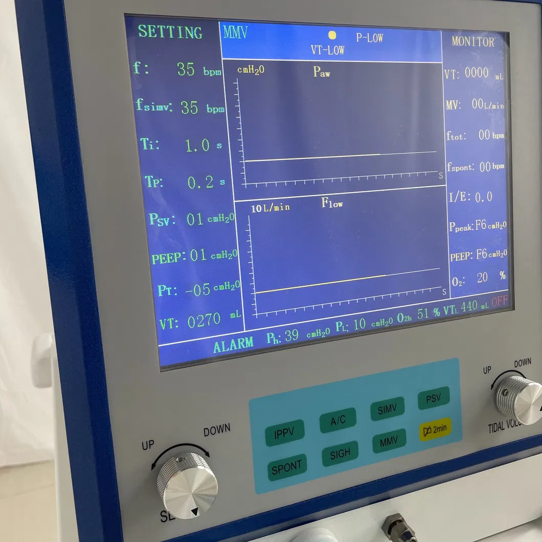 ICU Ventilator Component 1