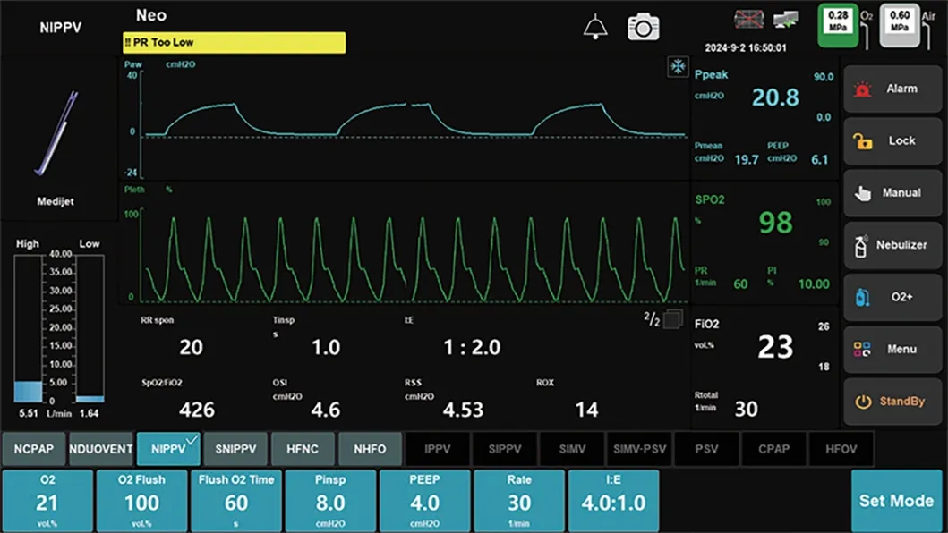 Monitoring Parameters