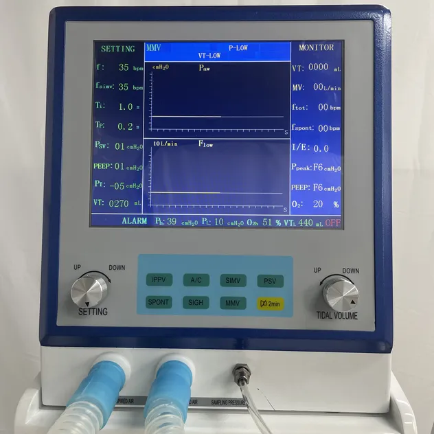 Ventilator Interface 1
