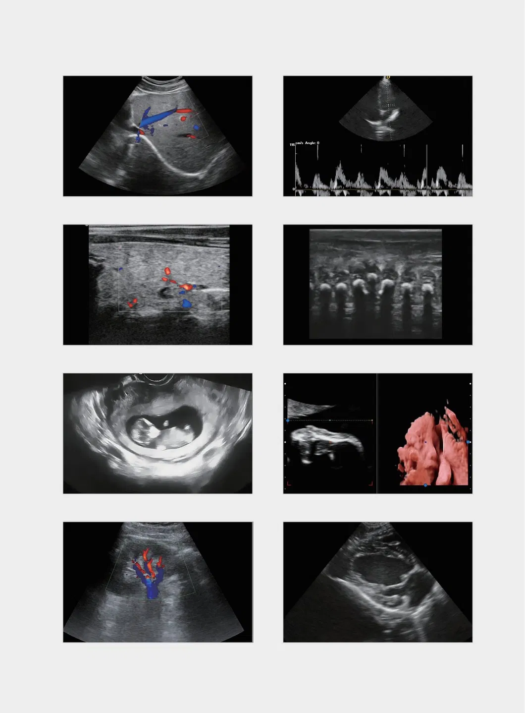 Ultrasound View 6