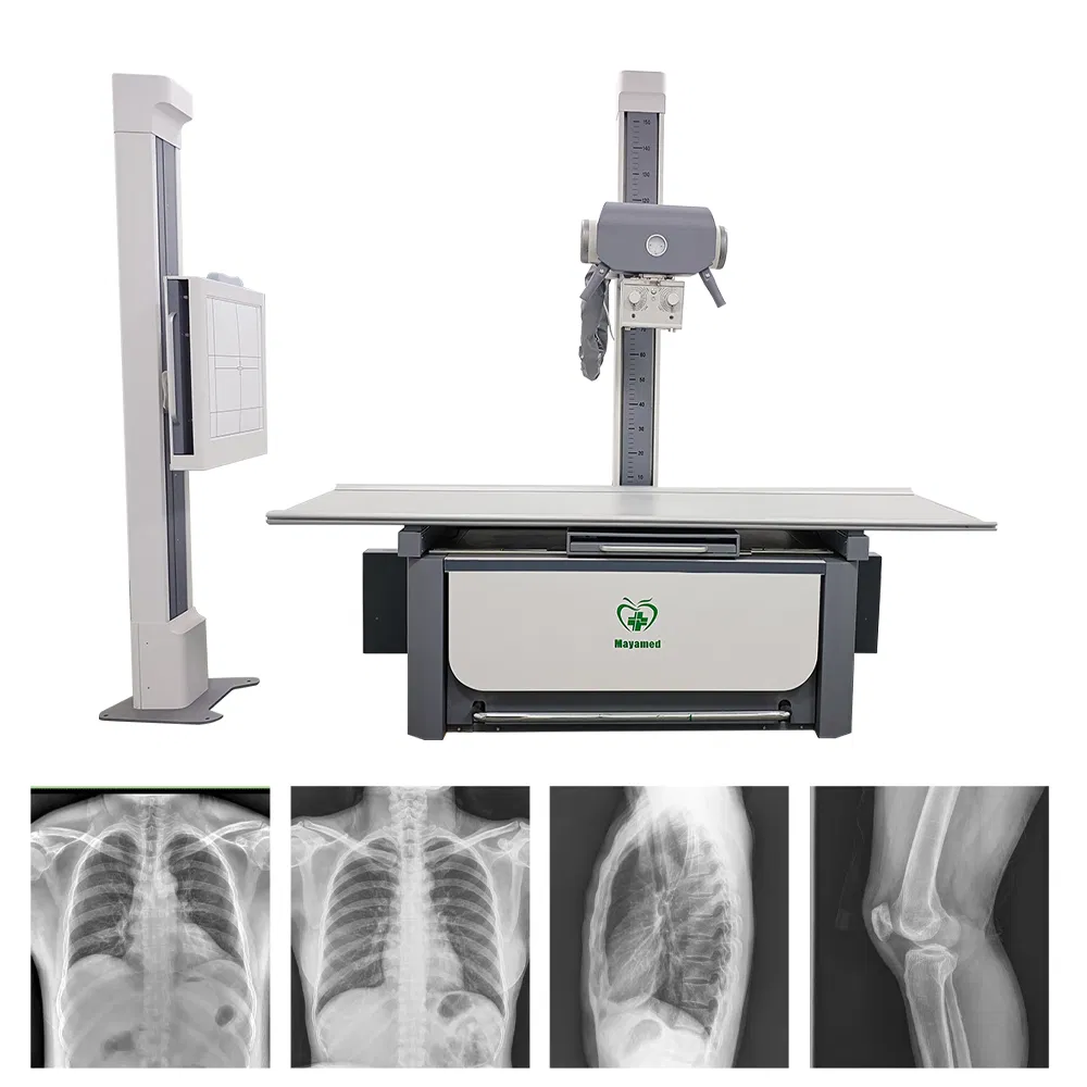 Medical Diagnostic Hf 300mA 320mA Floor-Mounted Hospital Equipment High Frequency Digital X-ray Machine