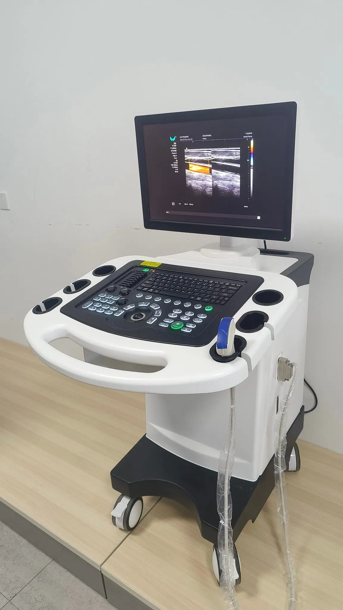 Best Price Hospital Use Trolley Design Diagnostic System Ultrasound Medical Equipment