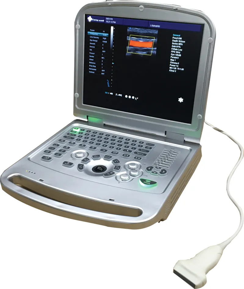 Ultrasound Diagnostic Scan Details