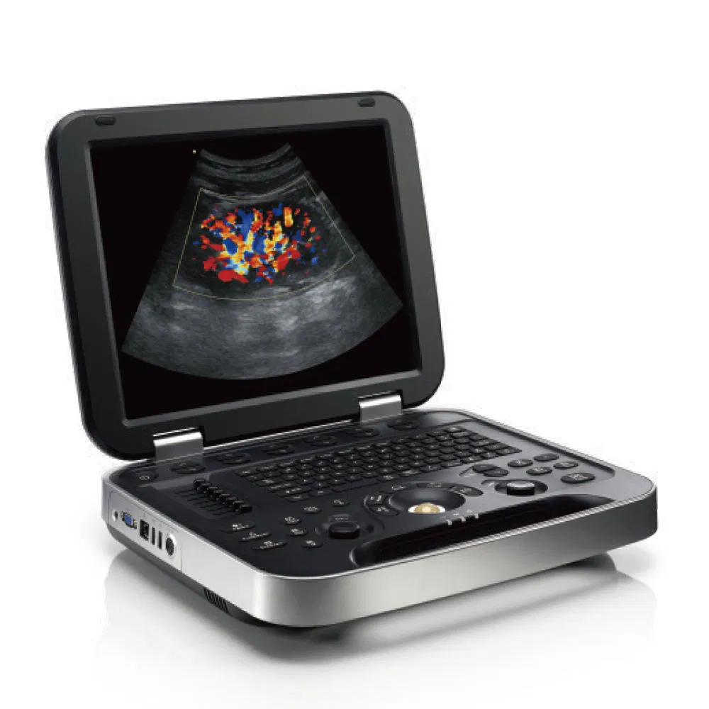 Advanced Premium Diagnostic Ultrasound System for Clinical Imaging