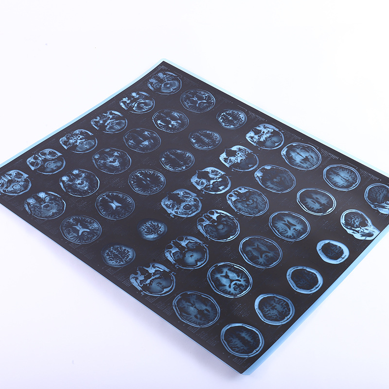 Reliable Medical Dry Diagnostic High Resolution Long-Lasting Durable Film Denta Hospital Equipment