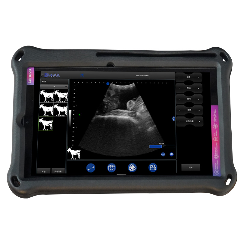 Bxl-S104 Wireless Portable Ultrasound Machine System for Sale with HD Image General Probe