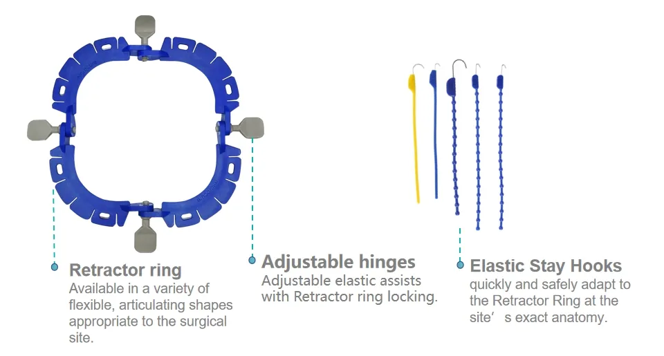 Surgery Retractor System Features 1