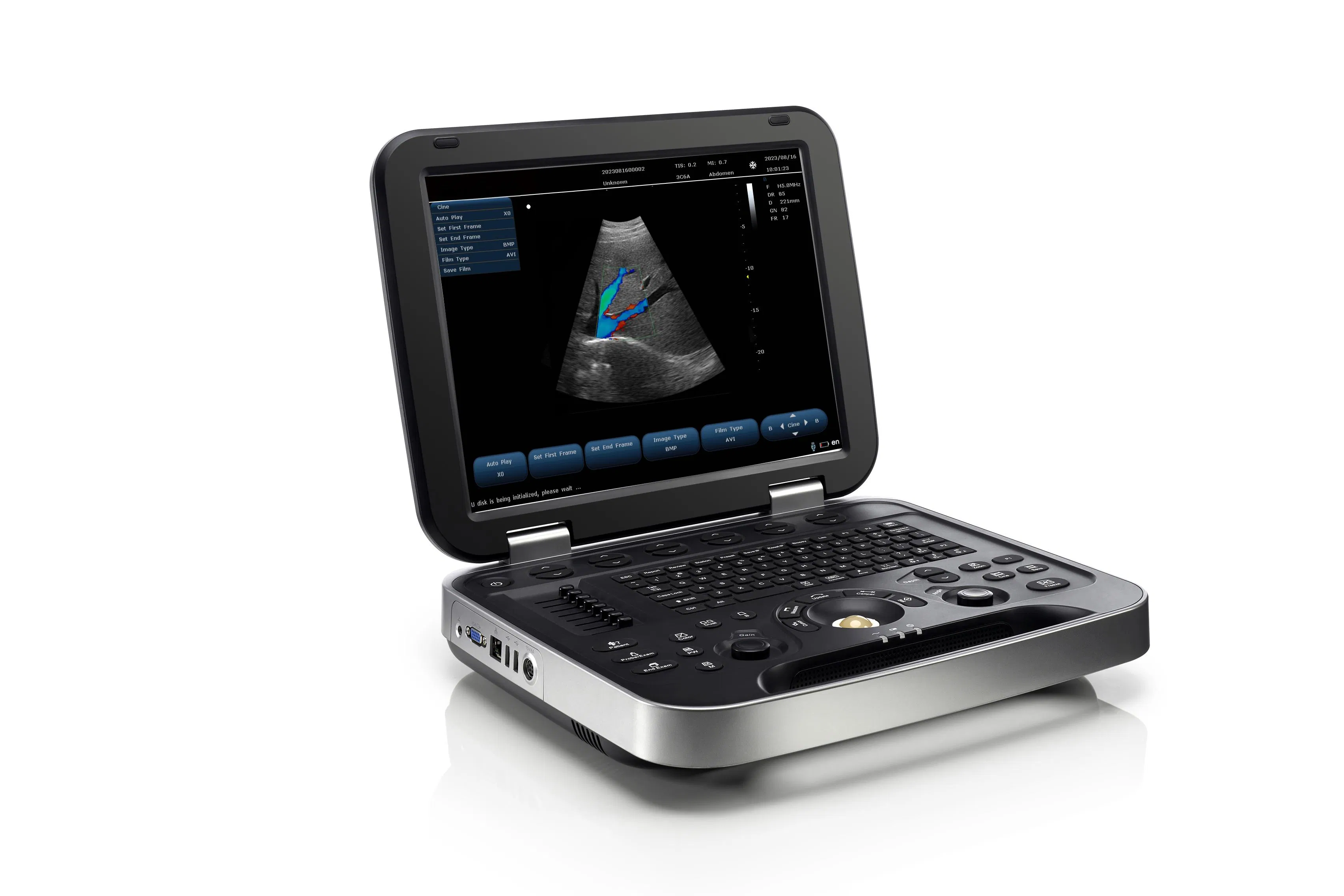 Advanced Premium Diagnostic Ultrasound System for Clinical Imaging