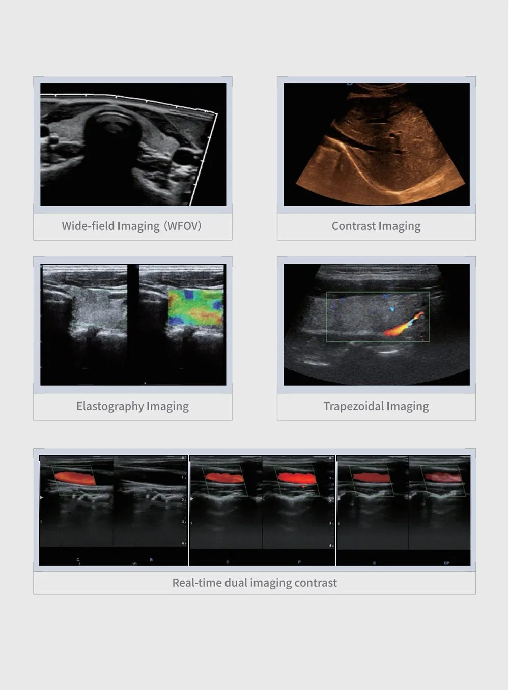 Ultrasound Imaging 6