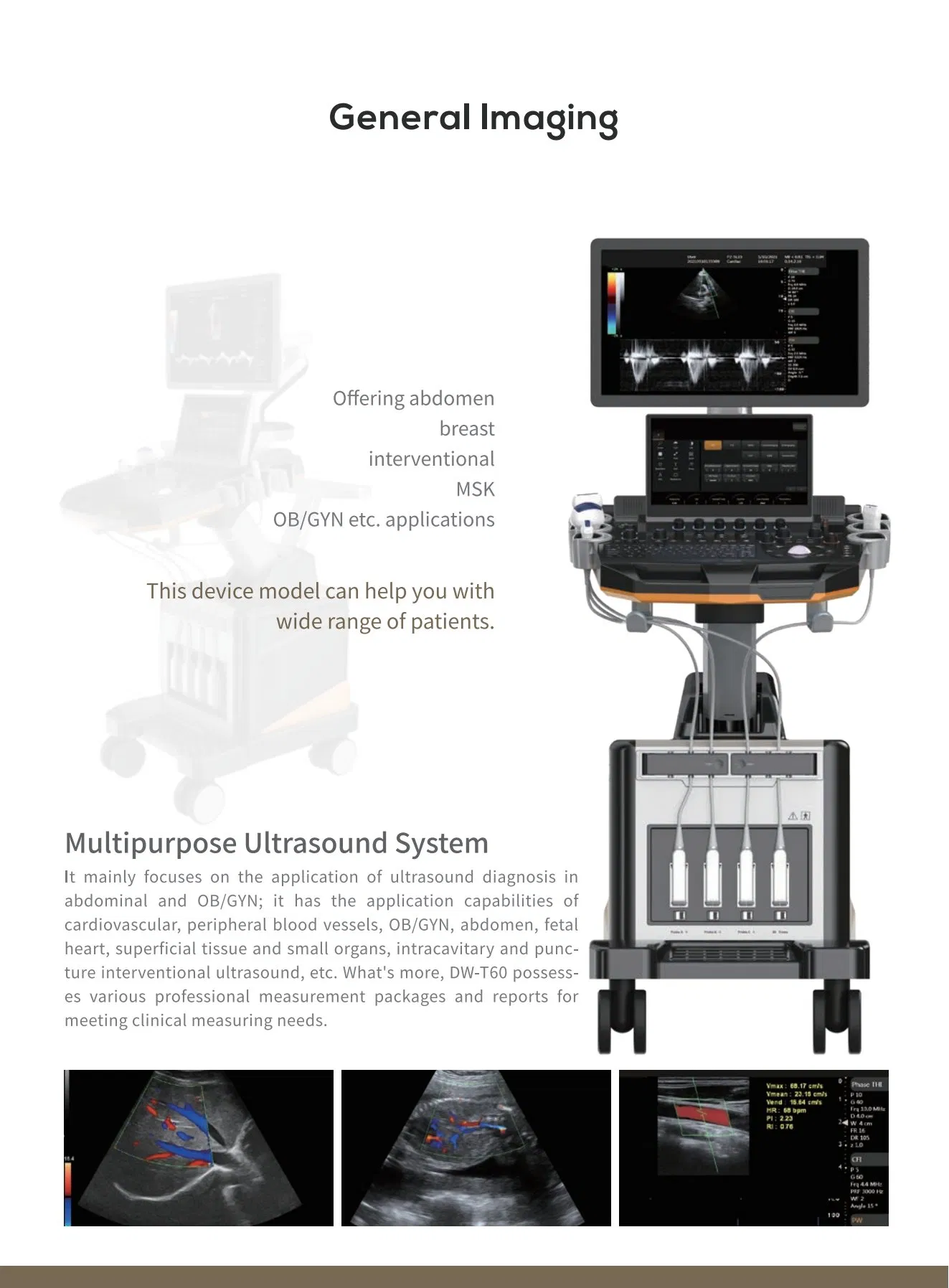 High-End Trolley-Type Color Doppler Ultrasound System--Advanced Imaging for Abdomen, Ob/Gyn, Cardiac &amp; Vascular Diagnostics