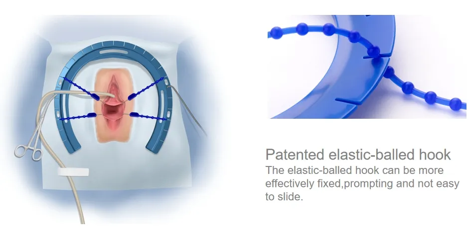 Surgery Retractor System Features 3