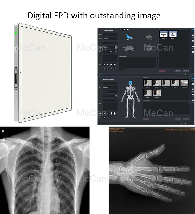 Medical Xray Imaging Diagnostic Equipment for Hospital