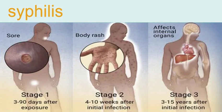 Process Illustration