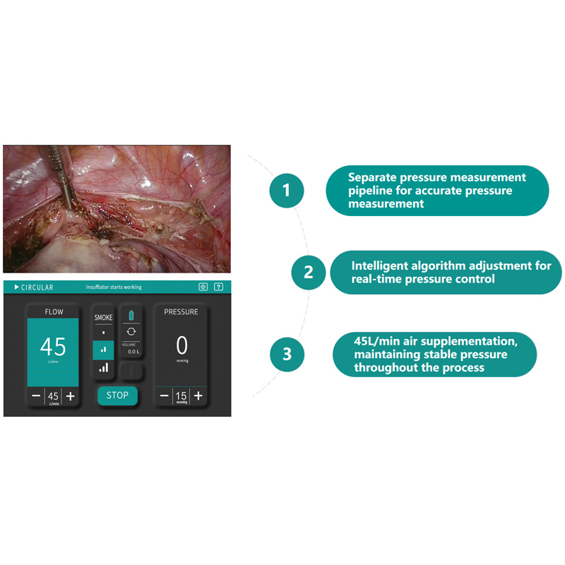 All in One Endoscopic Intelligent Insufflator System Constant Pressure Instant Smoke Evacuation Cyclic Filtration