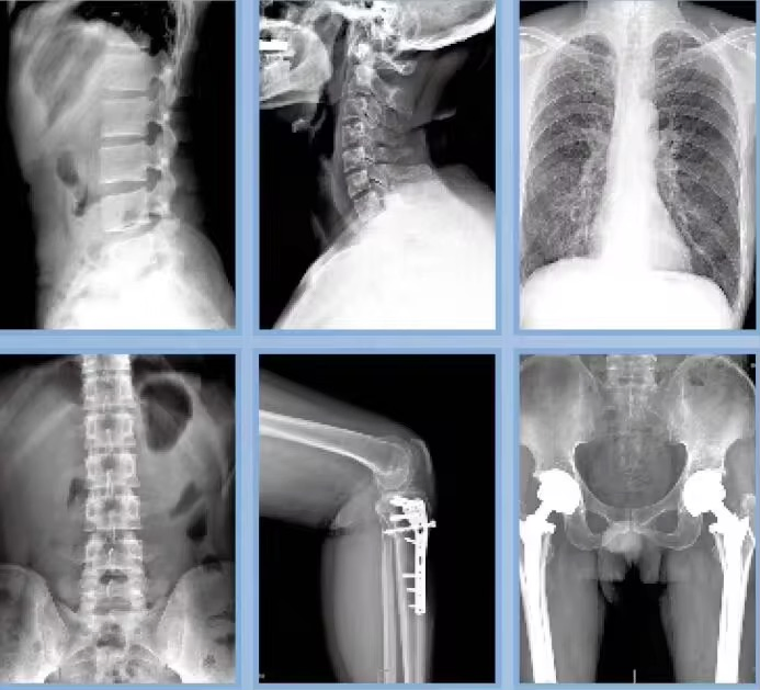 Digital Xray Machine 500mA Electric Operation Medical Diagnostic Xray Machine