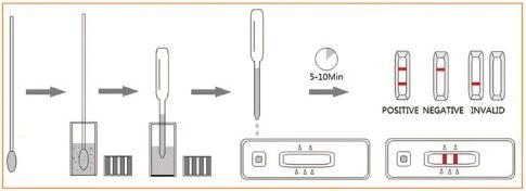 Poultry Infectious Bursal Disease Virus Antigen Test Kit (IBDV AG)