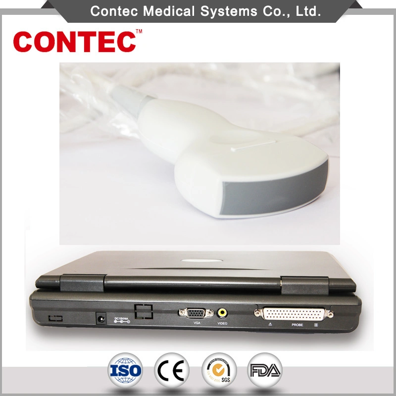Contec Cms600p2 Hopital Medical Equipment Notebook Diagnostic Ultrasound System